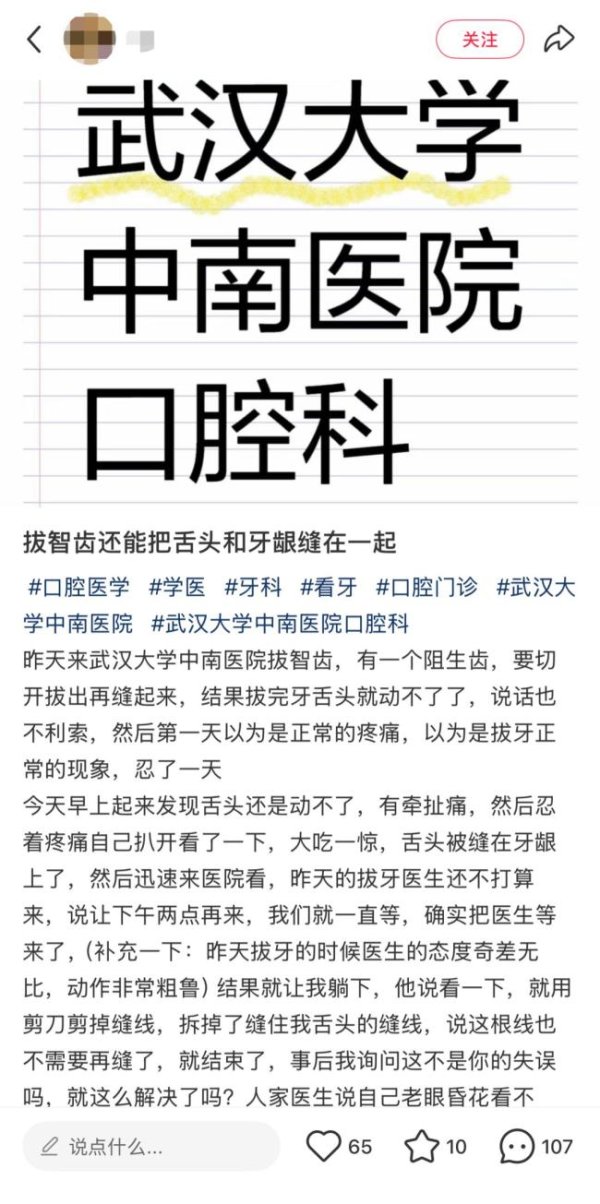 万达策略 女子拔智齿舌头被缝到牙龈上 医院正调查处理